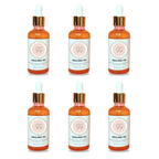 6 Bottles Healing Oil