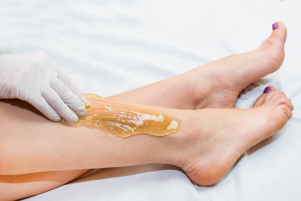 Person applying sugar wax to leg